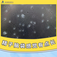 精(jīng)子的小(xiǎo)头头，越長(cháng)（chang）越好吗？