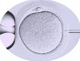 已经做了ICSI，為(wèi)什么还会受精(jīng)失败？